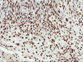 m00592 1 anti samhd1 mouse monoclonal antibody clone id oti1a1 ihc testing 8