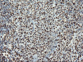m00592 1 anti samhd1 mouse monoclonal antibody clone id oti1a1 ihc testing 9