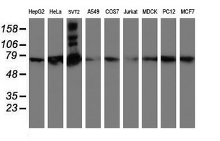 m00592 1 anti samhd1 mouse monoclonal antibody clone id oti1a1 wb testing 2