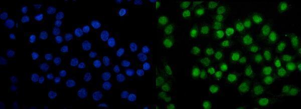 m00592 2 samhd1 primary antibodies if testing 10
