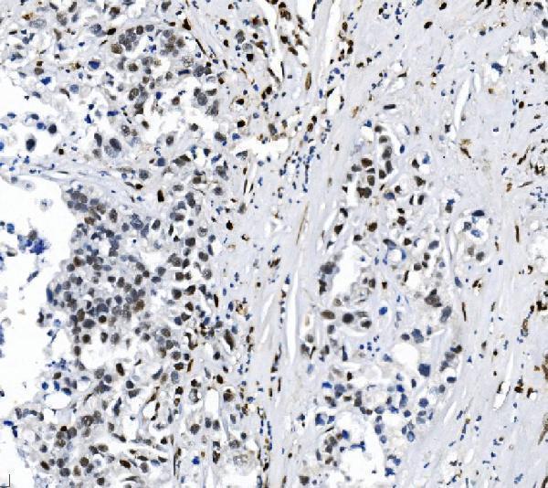 m00592 2 samhd1 primary antibodies ihc testing 2