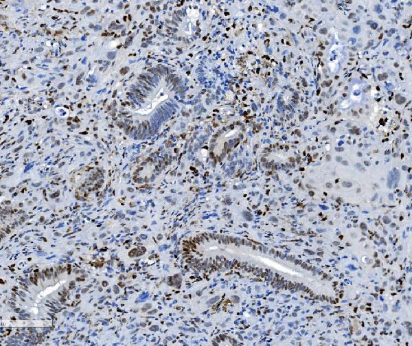 m00592 2 samhd1 primary antibodies ihc testing 6