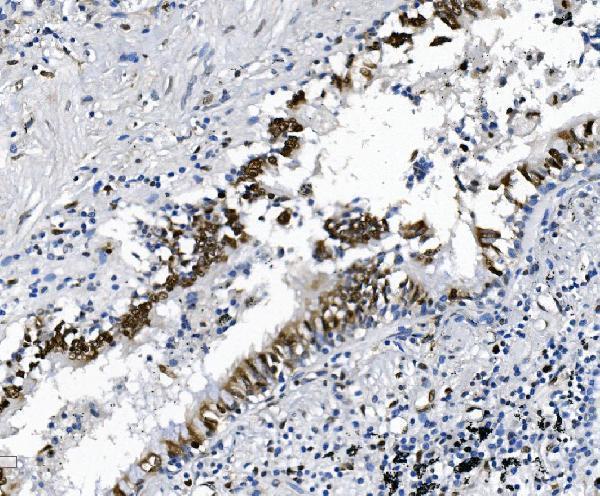 m00592 2 samhd1 primary antibodies ihc testing 7