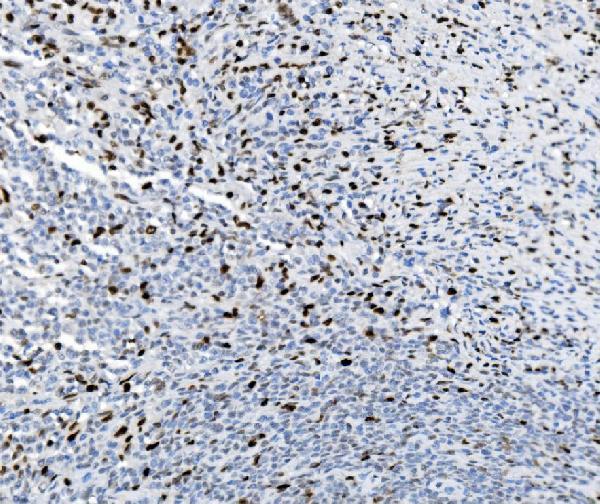 m00592 2 samhd1 primary antibodies ihc testing 8