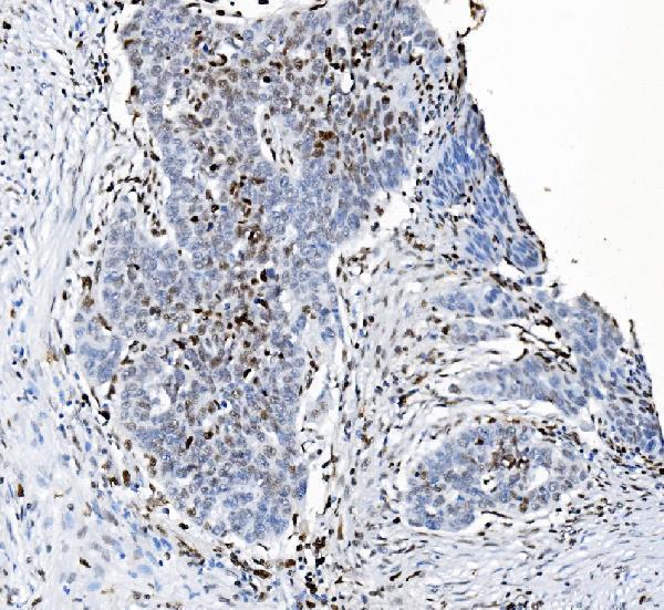 m00592 2 samhd1 primary antibodies ihc testing 9