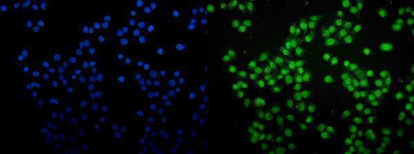 m00592 3 samhd1 primary antibodies if testing 13