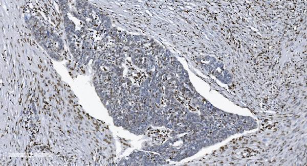 m00592 3 samhd1 primary antibodies ihc testing 11