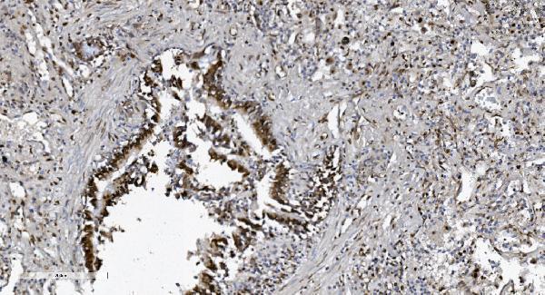 m00592 3 samhd1 primary antibodies ihc testing 12