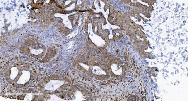  IHC analysis of SAMHD1 using anti-SAMHD1 antibody (M00592-3)