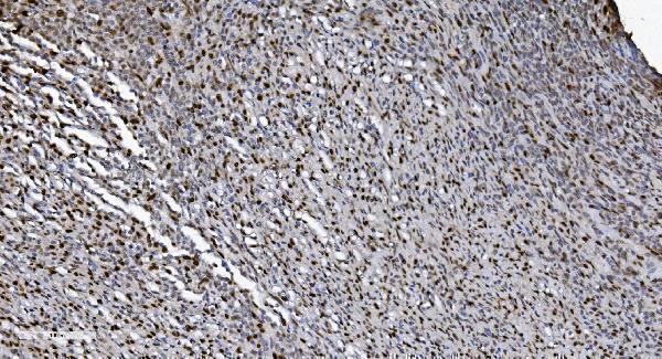 m00592 3 samhd1 primary antibodies ihc testing 3