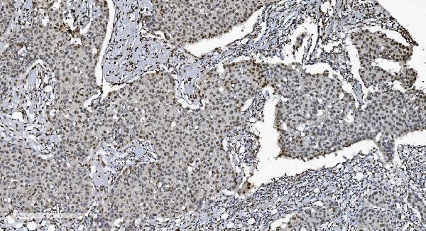 m00592 3 samhd1 primary antibodies ihc testing 4