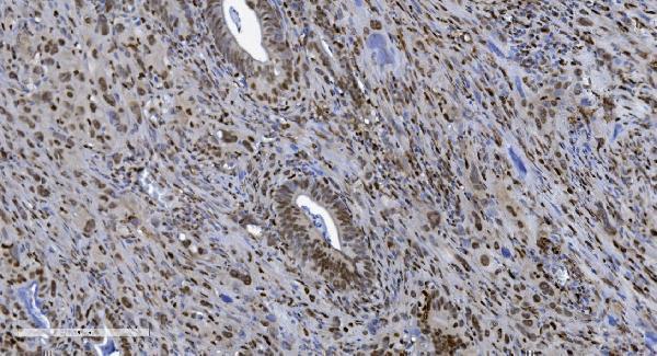 m00592 3 samhd1 primary antibodies ihc testing 5