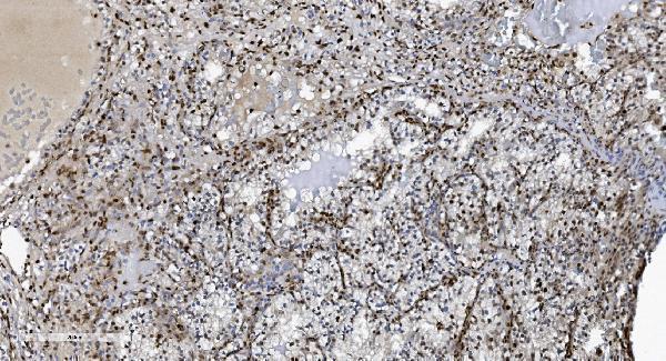 m00592 3 samhd1 primary antibodies ihc testing 6