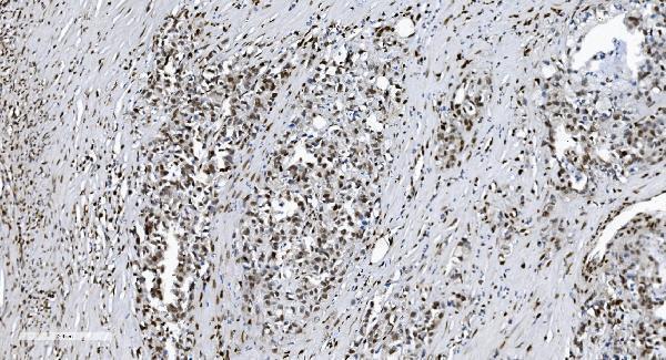 m00592 3 samhd1 primary antibodies ihc testing 7