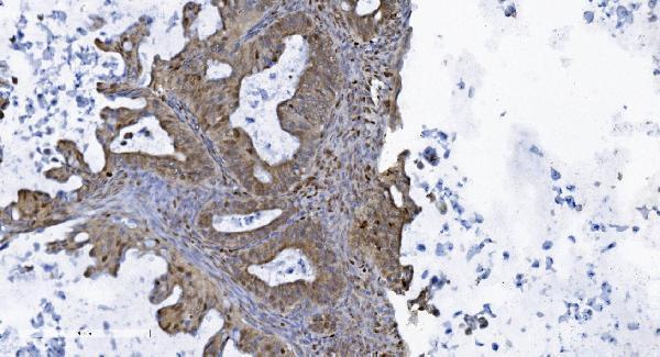 m00592 3 samhd1 primary antibodies ihc testing 8