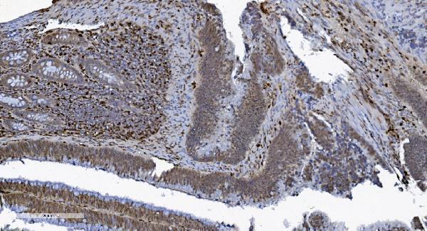 m00592 3 samhd1 primary antibodies ihc testing 9