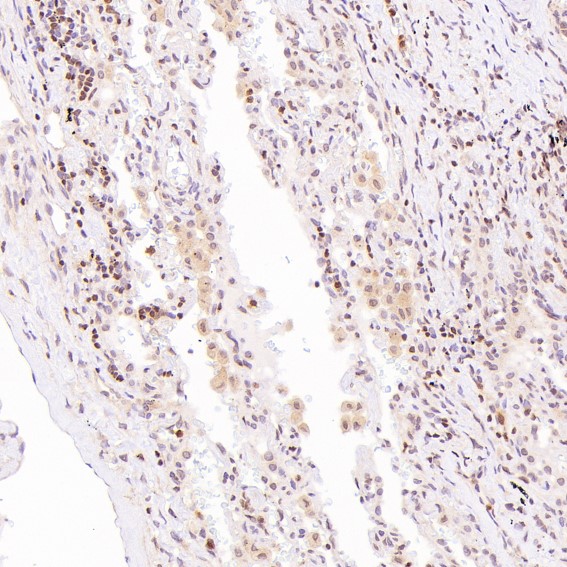 m00593 ihc10