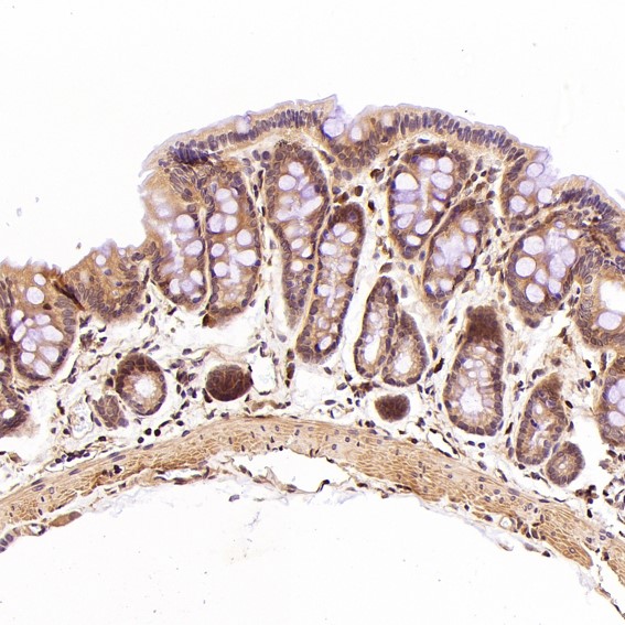 m00593 ihc7