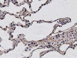 m00595 1 anti hdac6 mouse monoclonal antibody clone id oti3e7 ihc testing 11