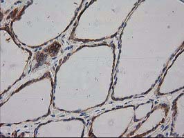 Immunohistochemical staining of paraffin-embedded Human thyroid tissue within the normal limits using anti-HDAC6 mouse monoclonal antibody