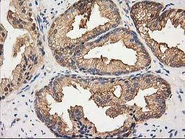 m00595 1 anti hdac6 mouse monoclonal antibody clone id oti3e7 ihc testing 4
