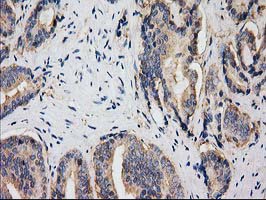 m00595 1 anti hdac6 mouse monoclonal antibody clone id oti3e7 ihc testing 5