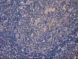 m00595 1 anti hdac6 mouse monoclonal antibody clone id oti3e7 ihc testing 6