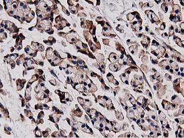 m00595 1 anti hdac6 mouse monoclonal antibody clone id oti3e7 ihc testing 8