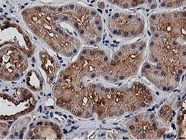 m00595 1 anti hdac6 mouse monoclonal antibody clone id oti3e7 ihc testing 9