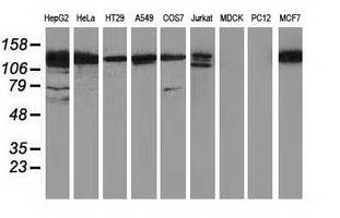 Western blot analysis of extracts (35ug) from 9 different cell lines by using anti-HDAC6 monoclonal antibody
