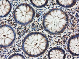 m00595 2 anti hdac6 mouse monoclonal antibody clone id oti4c5 ihc testing 4