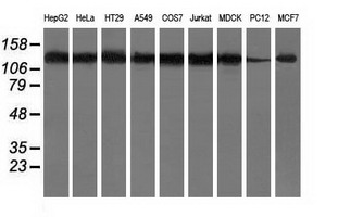 m00595 2 anti hdac6 mouse monoclonal antibody clone id oti4c5 wb testing 2