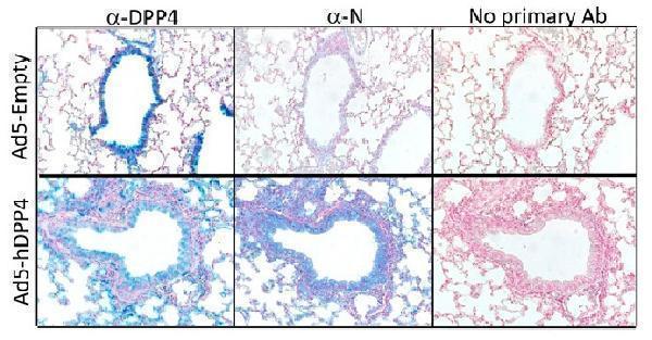 Figure from citation: Immunohistochemistry of DPP4 protein level by using anti-DPP4 antibody in lungs harvested from BALB/c mice at day 3