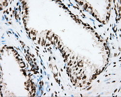 m00598 1 anti cytochrome p450 1a2 cyp1a2 mouse monoclonal antibody clone id oti6e2 ihc testing 6