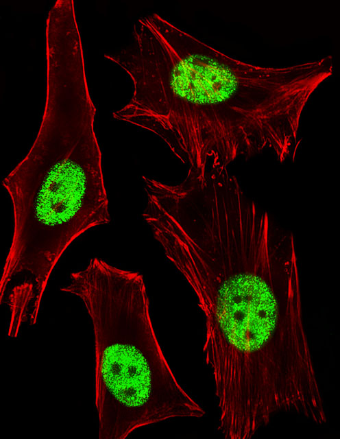 m00600 anti ppara antibody if testing 1