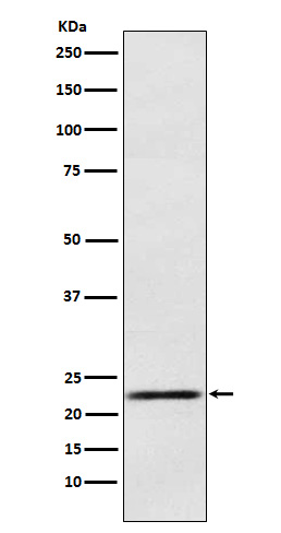 Western blot analysis of Prolactin expression in Human fetal pituitary lysate