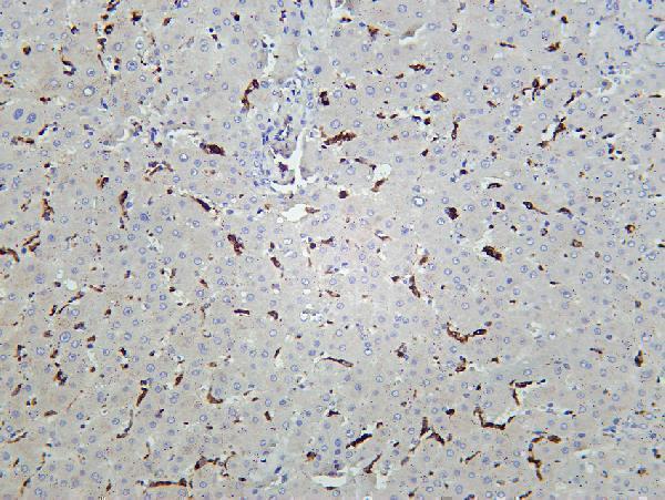 m00602 4 cd68 primary antibodies ihc testing 1