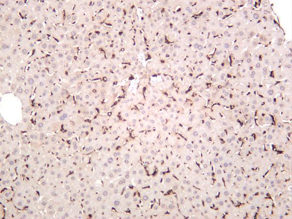 m00602 5 cd68 primary antibodies ihc testing 1