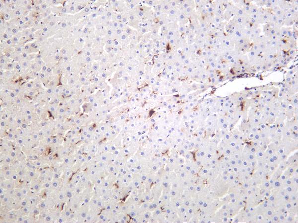 m00602 5 cd68 primary antibodies ihc testing 2