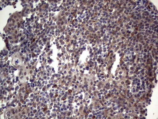 Immunohistochemical staining of paraffin-embedded Human tonsil within the normal limits using anti-TET1 mouse monoclonal antibody