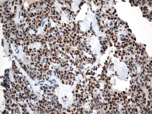 m00605 2 anti lef1 mouse monoclonal antibody clone id oti10a7 ihc testing 4