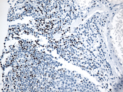 m00605 2 anti lef1 mouse monoclonal antibody clone id oti10a7 ihc testing 5