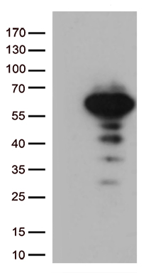 HEK293T cells were transfected with the pCMV6-ENTRY control (Left lane) or pCMV6-ENTRY LEF1 (Right lane) cDNA for 48 hrs and lysed