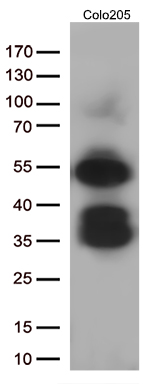 Western blot analysis of extracts (35ug) from Colo205 cells by using anti-LEF1 monoclonal antibody (1:500)
