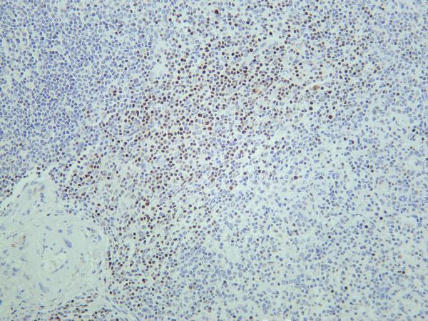 m00605 3 lef1 primary antibodies ihc testing 4