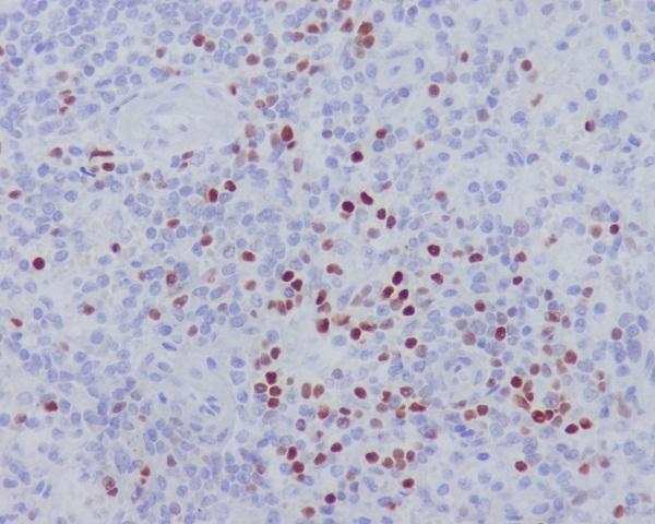 Immunohistochemical analysis of paraffin-embedded human spleen, using LEF1 Antibody