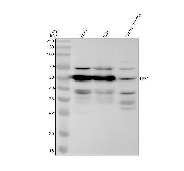 Western blot analysis of LEF1 using anti-LEF1 antibody (M00605)