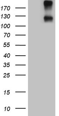 HEK293T cells were transfected with the pCMV6-ENTRY control (Left lane) or pCMV6-ENTRY IL23R (Right lane) cDNA for 48 hrs and lysed