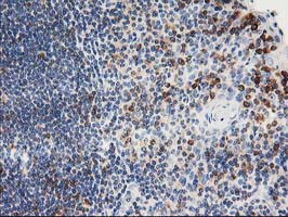 Immunohistochemical staining of paraffin-embedded Human lymph node tissue within the normal limits using anti-PTPN1 mouse monoclonal antibody
