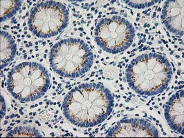 m00613 1 anti ptp1b ptpn1 mouse monoclonal antibody clone id oti1d10 ihc testing 6